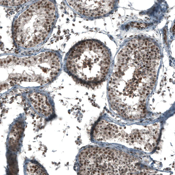 Immunohistochemistry (Formalin/PFA-fixed paraffin-embedded sections) - Anti-SOX7 antibody (AB220293)