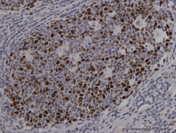 Immunohistochemistry (Formalin/PFA-fixed paraffin-embedded sections) - Anti-SOX9 antibody [3C10] - BSA and Azide free (AB76997)