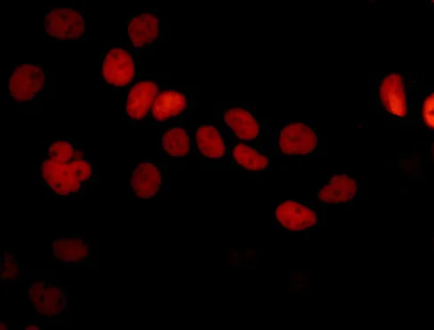 Immunocytochemistry/ Immunofluorescence - Anti-SOX9 antibody [EPR12755] - BSA and Azide free (AB250630)