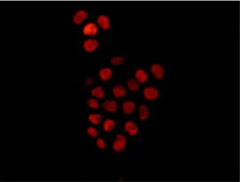 Immunocytochemistry/ Immunofluorescence - Anti-SOX9 antibody [EPR12755] - BSA and Azide free (AB250630)