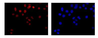 Immunocytochemistry/ Immunofluorescence - Anti-SOX9 antibody [EPR14335-78] (AB185966)