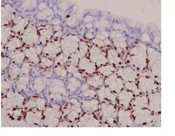 Immunohistochemistry (Formalin/PFA-fixed paraffin-embedded sections) - Anti-SOX9 antibody [EPR14335-78] (AB185966)