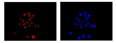 Immunocytochemistry/ Immunofluorescence - Anti-SOX9 antibody [EPR14335-78] - BSA and Azide free (AB225541)