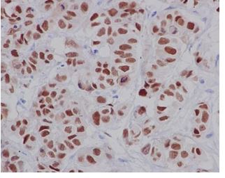 Immunohistochemistry (Formalin/PFA-fixed paraffin-embedded sections) - Anti-SOX9 antibody [EPR14335-78] - BSA and Azide free (AB225541)