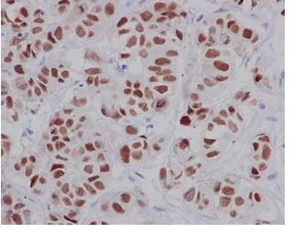 Immunohistochemistry (Formalin/PFA-fixed paraffin-embedded sections) - Anti-SOX9 antibody [EPR14335-78] - BSA and Azide free (AB225541)