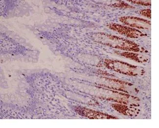 Immunohistochemistry (Formalin/PFA-fixed paraffin-embedded sections) - Anti-SOX9 antibody [EPR14335-78] - BSA and Azide free (AB225541)