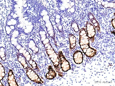 Immunohistochemistry (Formalin/PFA-fixed paraffin-embedded sections) - Anti-SOX9 antibody [EPR14335-78] - BSA and Azide free (AB225541)