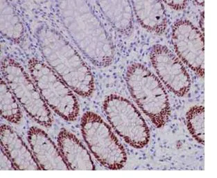 Immunohistochemistry (Formalin/PFA-fixed paraffin-embedded sections) - Anti-SOX9 antibody [EPR14335-78] - BSA and Azide free (AB225541)