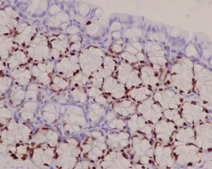 Immunohistochemistry (Formalin/PFA-fixed paraffin-embedded sections) - Anti-SOX9 antibody [EPR14335] (AB185230)