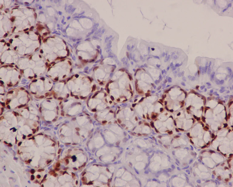 Immunohistochemistry (Formalin/PFA-fixed paraffin-embedded sections) - Anti-SOX9 antibody [EPR14335] (AB185230)