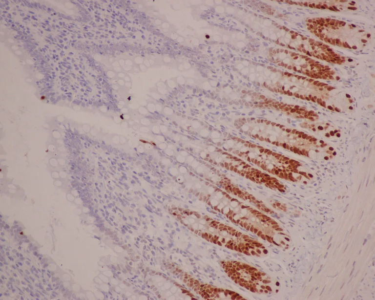 Immunohistochemistry (Formalin/PFA-fixed paraffin-embedded sections) - Anti-SOX9 antibody [EPR14335] (AB185230)