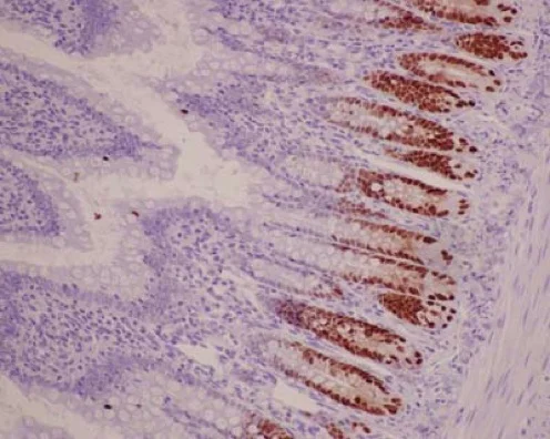Immunohistochemistry (Formalin/PFA-fixed paraffin-embedded sections) - Anti-SOX9 antibody [EPR14335] (AB185230)
