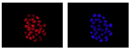 Immunocytochemistry/ Immunofluorescence - Anti-SOX9 antibody [EPR14335] - BSA and Azide free (AB220812), expandable thumbnail