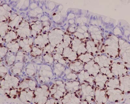 Immunohistochemistry (Formalin/PFA-fixed paraffin-embedded sections) - Anti-SOX9 antibody [EPR14335] - BSA and Azide free (AB220812), expandable thumbnail