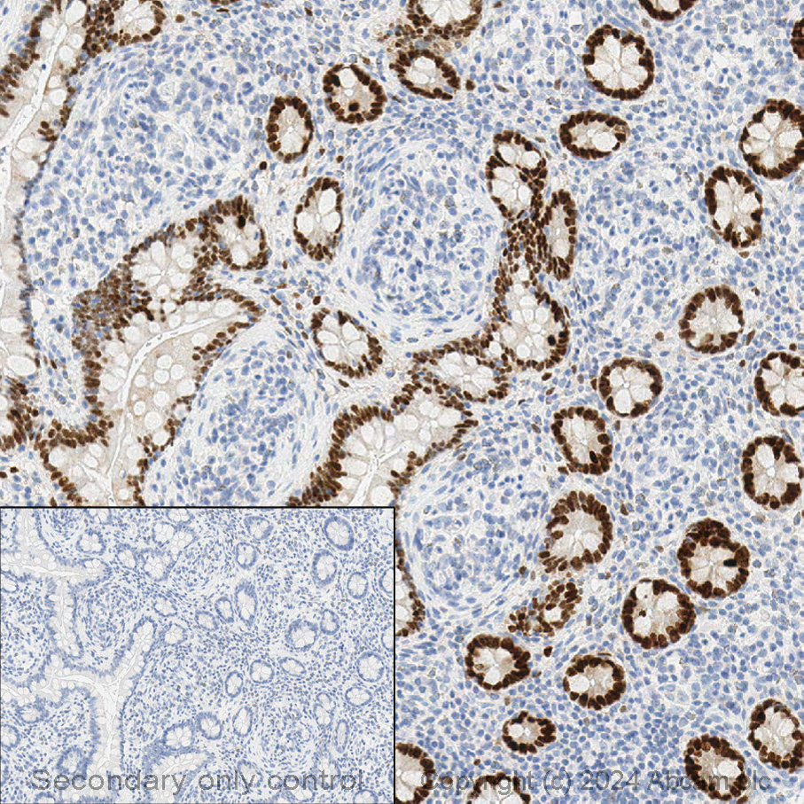 Immunohistochemistry (Formalin/PFA-fixed paraffin-embedded sections) - Anti-SOX9 antibody [EPR14335] - BSA and Azide free (ab220812), expandable thumbnail