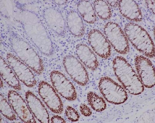 Immunohistochemistry (Formalin/PFA-fixed paraffin-embedded sections) - Anti-SOX9 antibody [EPR14335] - BSA and Azide free (AB220812), expandable thumbnail