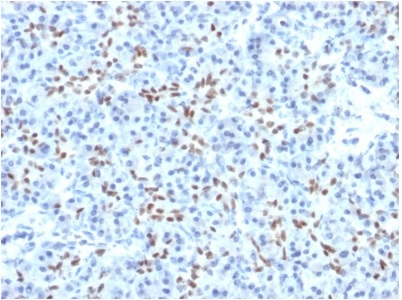 Immunohistochemistry (Formalin/PFA-fixed paraffin-embedded sections) - Anti-SOX9 antibody [PCRP-SOX9-1A2] (AB238053)