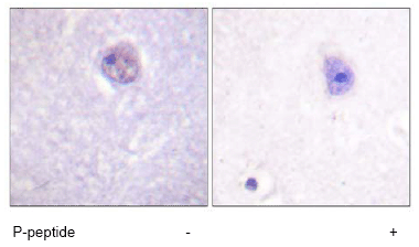 Immunohistochemistry (Formalin/PFA-fixed paraffin-embedded sections) - Anti-SOX9 (phospho S181) antibody (AB59252), expandable thumbnail