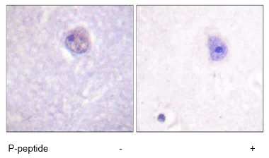 Immunohistochemistry (Formalin/PFA-fixed paraffin-embedded sections) - Anti-SOX9 (phospho S181) antibody (AB59252)