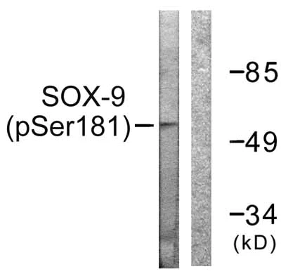 Western blot - Anti-SOX9 (phospho S181) antibody (AB59252)