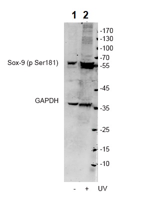 Western blot - Anti-SOX9 (phospho S181) antibody (AB59252), expandable thumbnail