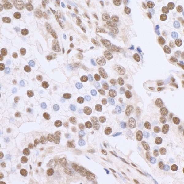 Immunohistochemistry (Formalin/PFA-fixed paraffin-embedded sections) - Anti-SP1 antibody (AB13370)