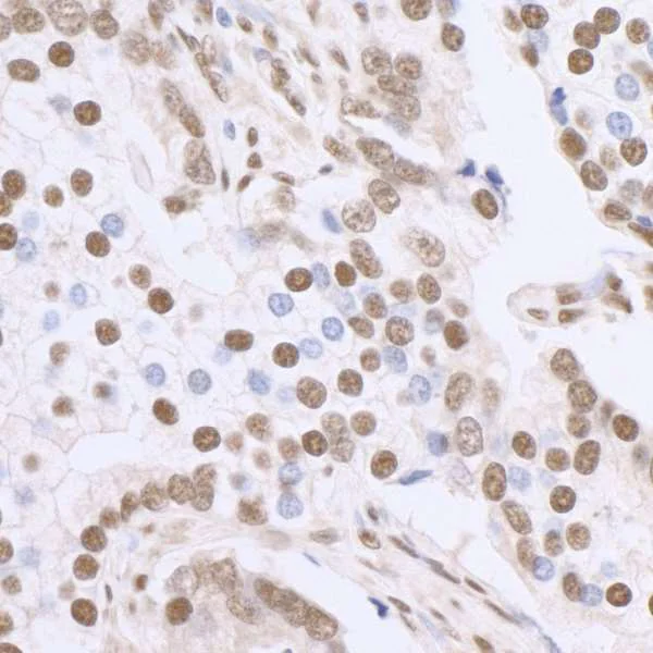 Immunohistochemistry (Formalin/PFA-fixed paraffin-embedded sections) - Anti-SP1 antibody (AB13370)