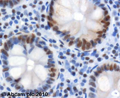 Immunohistochemistry (Formalin/PFA-fixed paraffin-embedded sections) - Anti-SP1 antibody (AB13370)