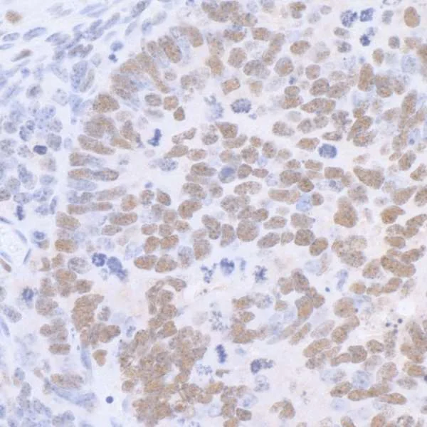 Immunohistochemistry (Formalin/PFA-fixed paraffin-embedded sections) - Anti-SP1 antibody (AB13370)