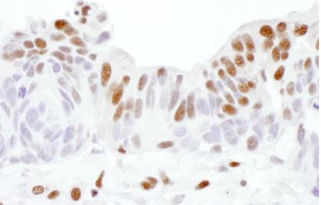 Immunohistochemistry (Formalin/PFA-fixed paraffin-embedded sections) - Anti-SP1 antibody (AB157123)