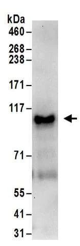 Immunoprecipitation - Anti-SP1 antibody (AB157123)
