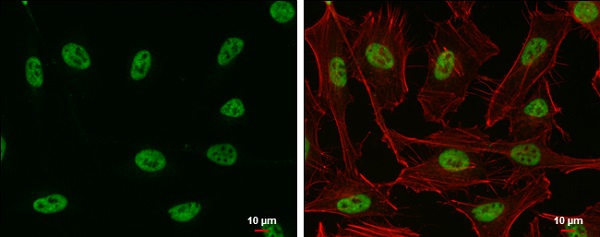 Immunocytochemistry/ Immunofluorescence - Anti-SP1 antibody (AB227383), expandable thumbnail