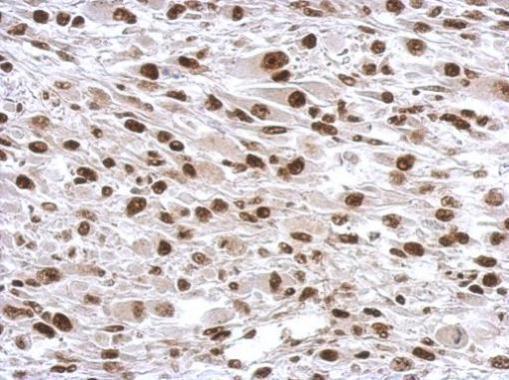 Immunohistochemistry (Formalin/PFA-fixed paraffin-embedded sections) - Anti-SP1 antibody (ab227383), expandable thumbnail