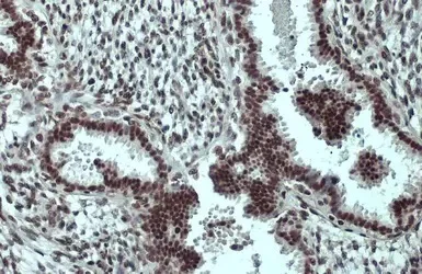 Immunohistochemistry (Formalin/PFA-fixed paraffin-embedded sections) - Anti-SP1 antibody (AB227383)