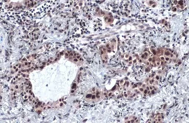 Immunohistochemistry (Formalin/PFA-fixed paraffin-embedded sections) - Anti-SP1 antibody (AB227383)
