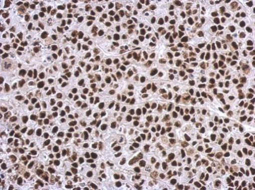 Immunohistochemistry (Formalin/PFA-fixed paraffin-embedded sections) - Anti-SP1 antibody (AB227383), expandable thumbnail