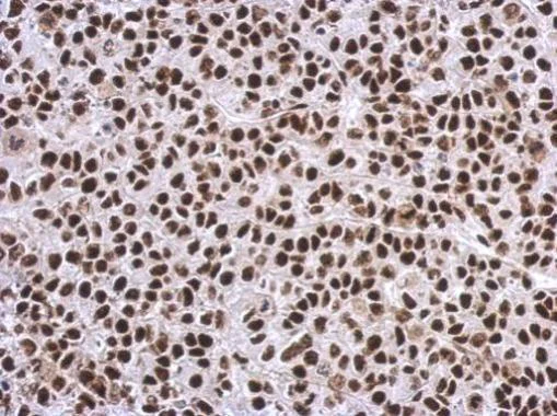 Immunohistochemistry (Formalin/PFA-fixed paraffin-embedded sections) - Anti-SP1 antibody (AB227383)