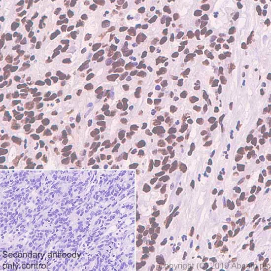 Immunohistochemistry (Formalin/PFA-fixed paraffin-embedded sections) - Anti-SP1 antibody [EPR22648-50] - BSA and Azide free (AB255289)