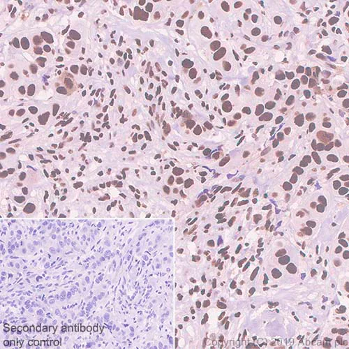 Immunohistochemistry (Formalin/PFA-fixed paraffin-embedded sections) - Anti-SP1 antibody [EPR22648-50] - BSA and Azide free (AB255289)