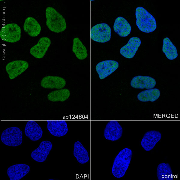 Immunocytochemistry/ Immunofluorescence - Anti-SP1 antibody [EPR6662(B)] (AB124804), expandable thumbnail