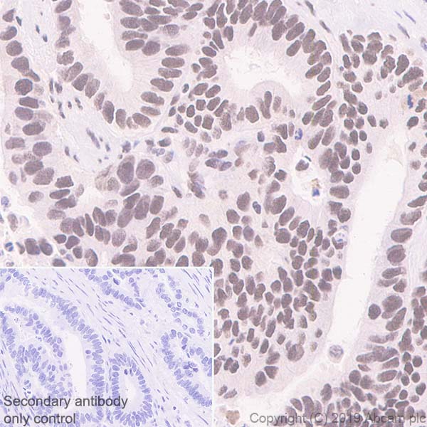 Immunohistochemistry (Formalin/PFA-fixed paraffin-embedded sections) - Anti-SP1 antibody [EPR6662(B)] (AB124804), expandable thumbnail