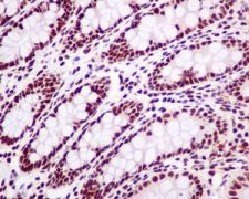 Immunohistochemistry (Formalin/PFA-fixed paraffin-embedded sections) - Anti-SP1 antibody [EPR6662(B)] (ab124804), expandable thumbnail