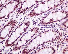 Immunohistochemistry (Formalin/PFA-fixed paraffin-embedded sections) - Anti-SP1 antibody [EPR6662(B)] (AB124804)