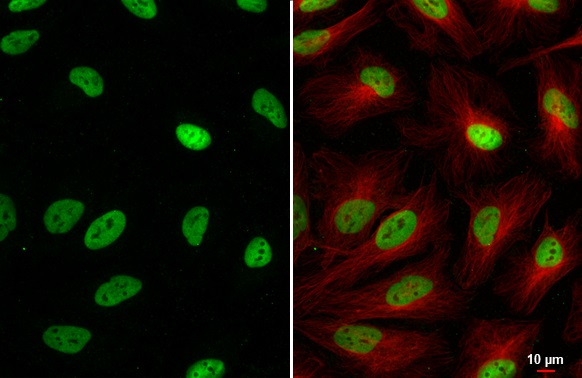 Immunocytochemistry/ Immunofluorescence - Anti-SP1 antibody [HL1396] (ab308364), expandable thumbnail