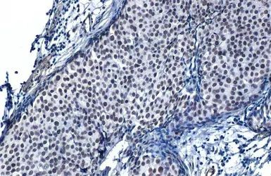 Immunohistochemistry paraffin embedded sections - Anti-SP1 antibody [HL1396] (ab308364), expandable thumbnail