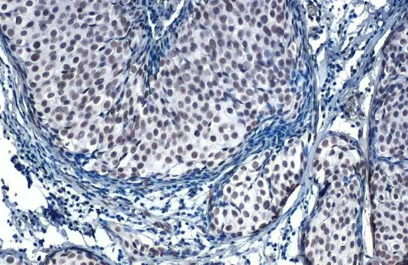 Immunohistochemistry paraffin embedded sections - Anti-SP1 antibody [HL1396] (AB308364)