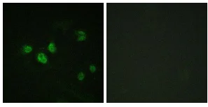 Immunocytochemistry - Anti-SP1 (phospho T453) antibody (AB59257)
