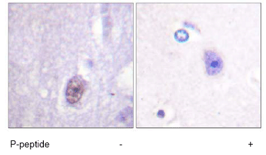Immunohistochemistry (Formalin/PFA-fixed paraffin-embedded sections) - Anti-SP1 (phospho T453) antibody (AB59257)