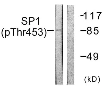 Western blot - Anti-SP1 (phospho T453) antibody (AB59257)
