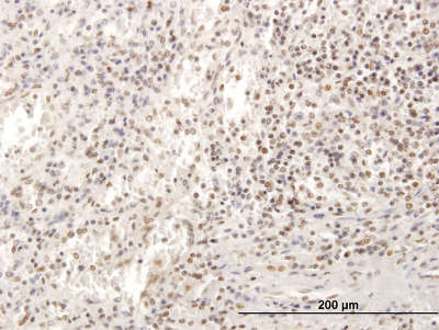 Immunohistochemistry (Formalin/PFA-fixed paraffin-embedded sections) - Anti-SP100 antibody (AB167605)